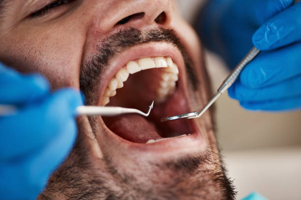 Best Dentist for Tooth Abscess  in Donora, PA